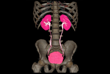 Virtual Colonoscopy