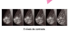 6 níveis de contraste