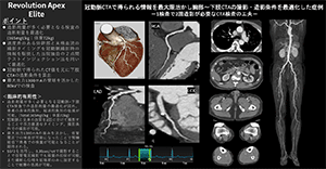 Cardiovascular05