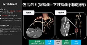 Cardiovascular10