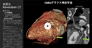 Cardiovascular10