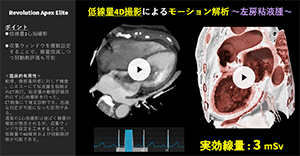 Cardiovascular10