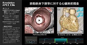 Cardiovascular10