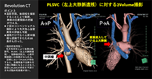 Cardiovascular10