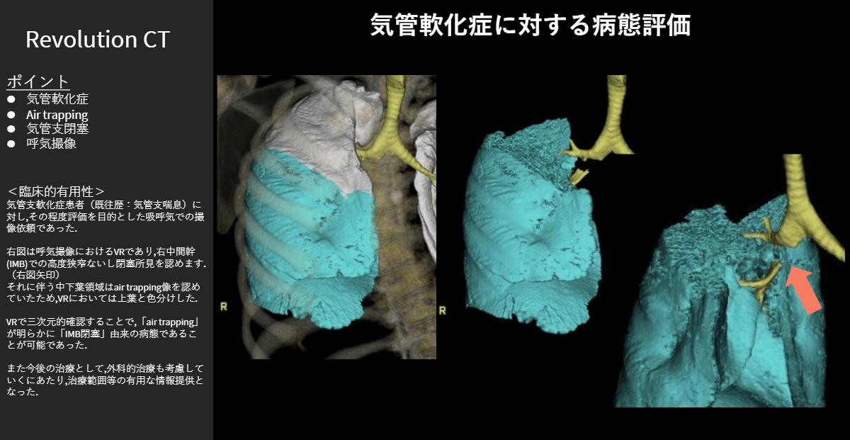 朝日大学病院 佐々木 陽介 様