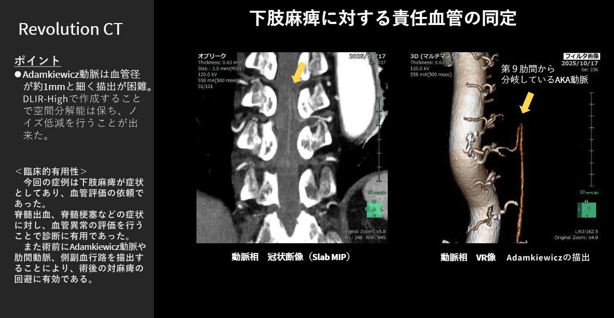 小山記念病院 福水 千紘 様