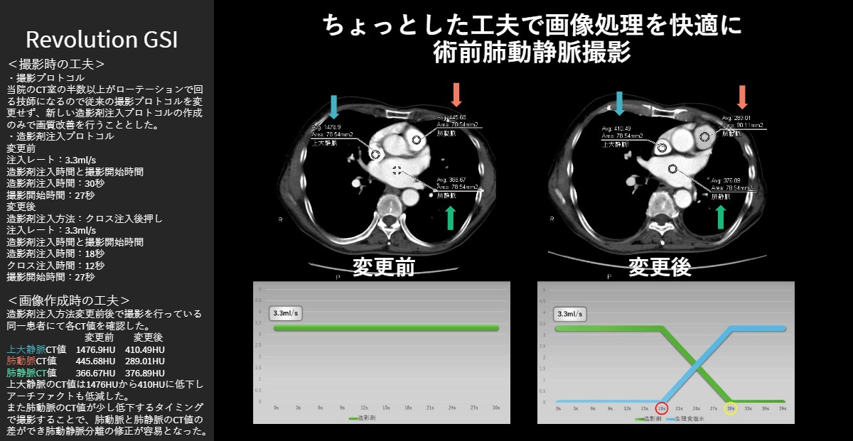 大阪赤十字病院 玉木 守 様