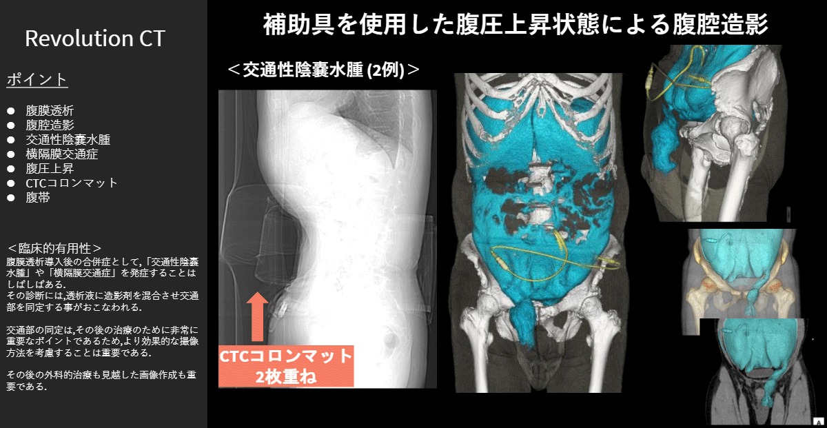 朝日大学病院 水谷 智 様