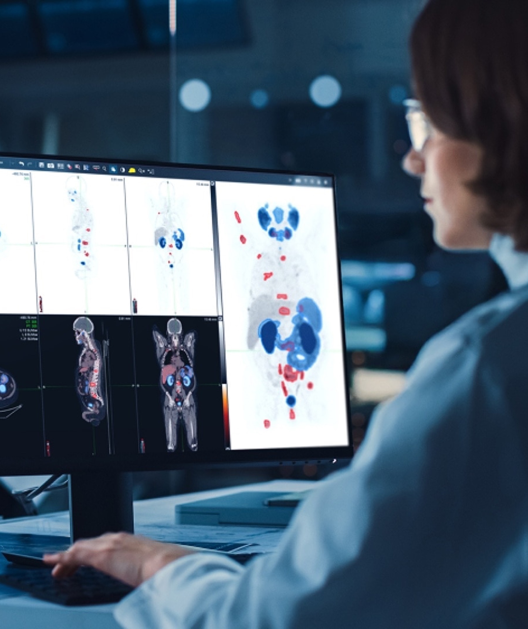 Take your MIM Solutions expertise further
