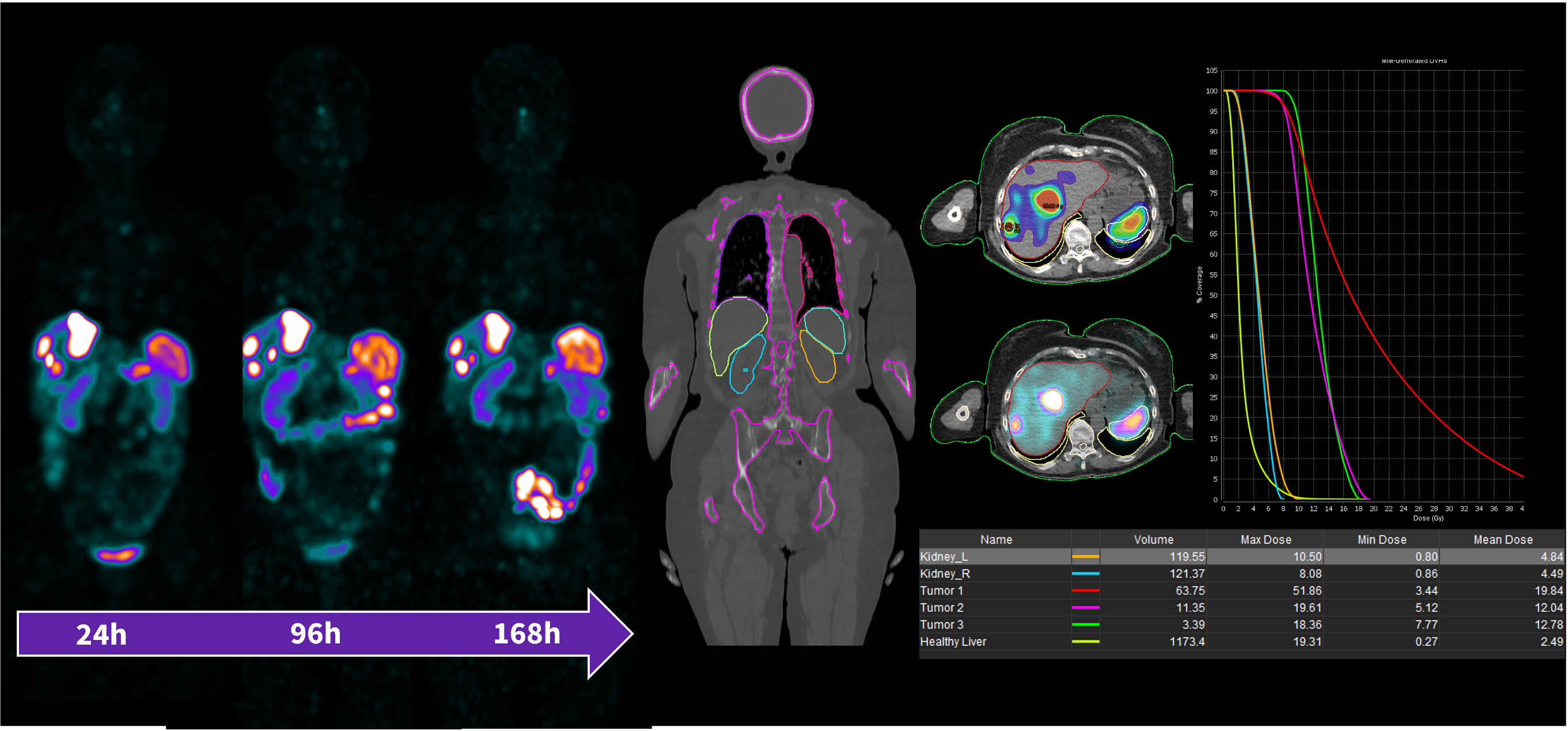 Dosimetry Workshop