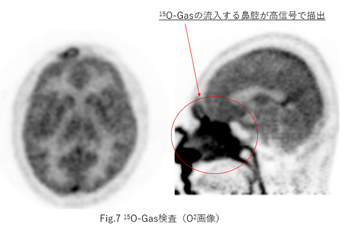 DMI_Shiga_09.png