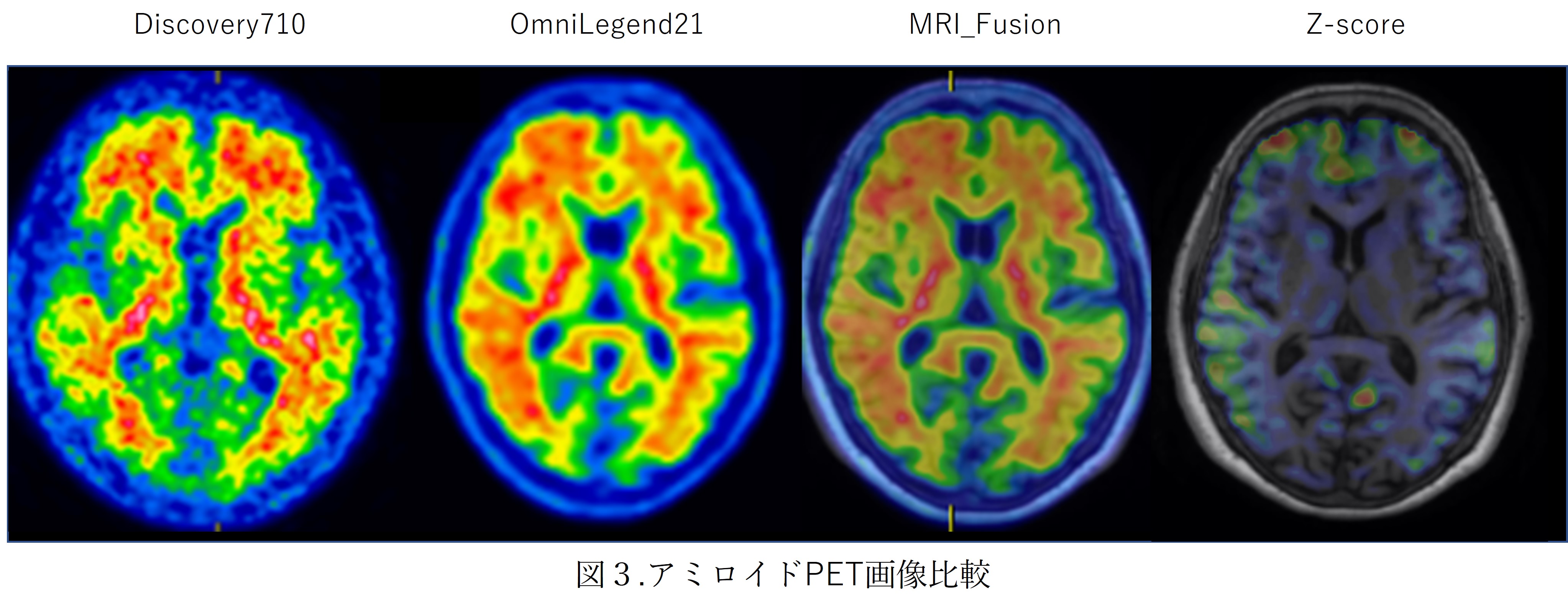 OmniLegend_Shiga03.jpg