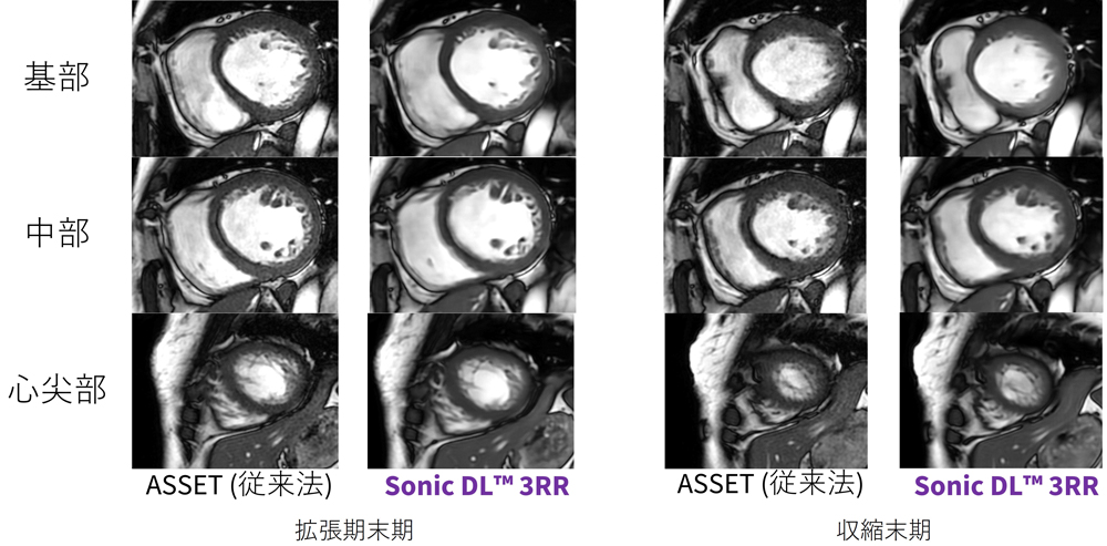 SonicDL_Iwateikadai03.jpg