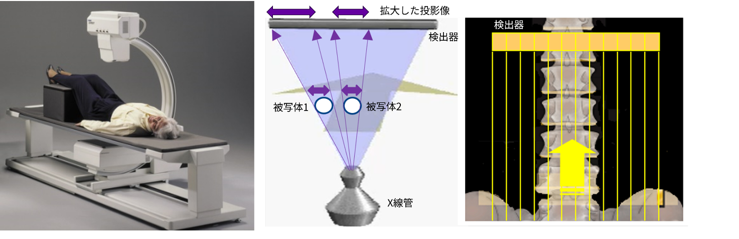 図1. ワイドファンビーム方式