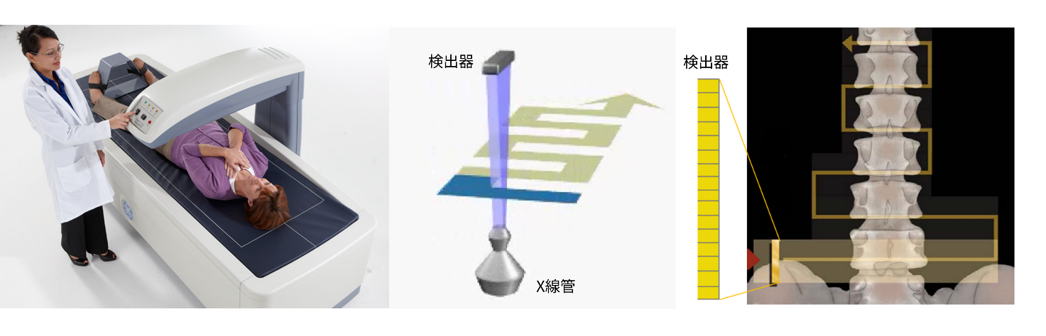 図2. 鋭角ファンビーム方式