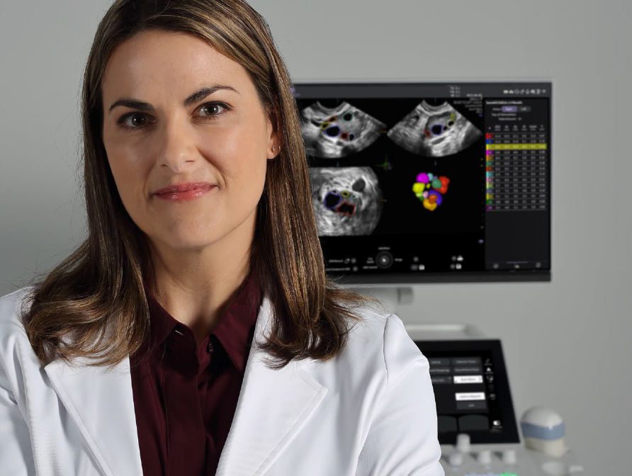 Voluson - Performance Series