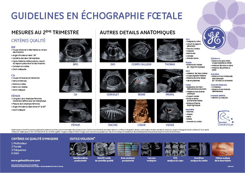 Echographie fœtale au 1er trimestre