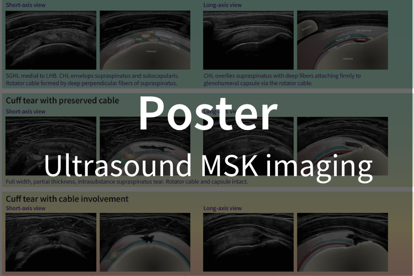 Poster / Ultrasound MSK imaging