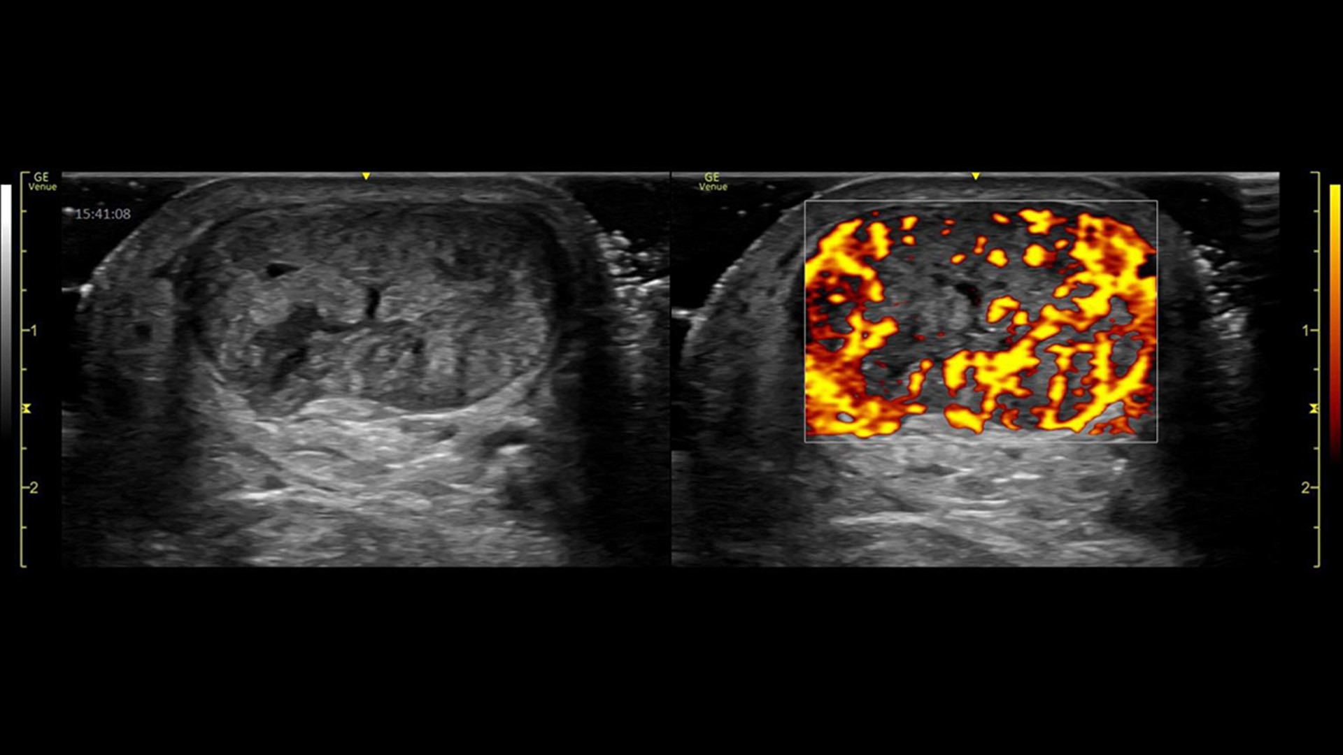 clinical-image