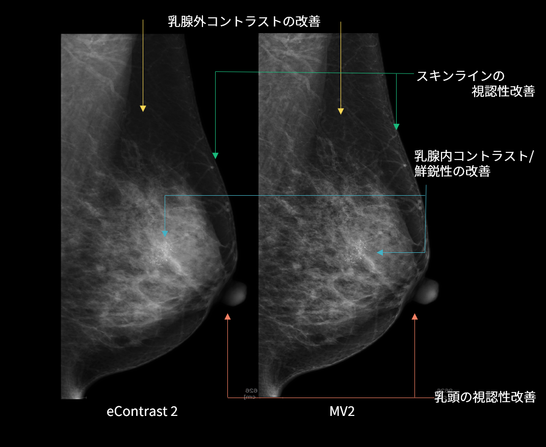 MV画像処理の変更点