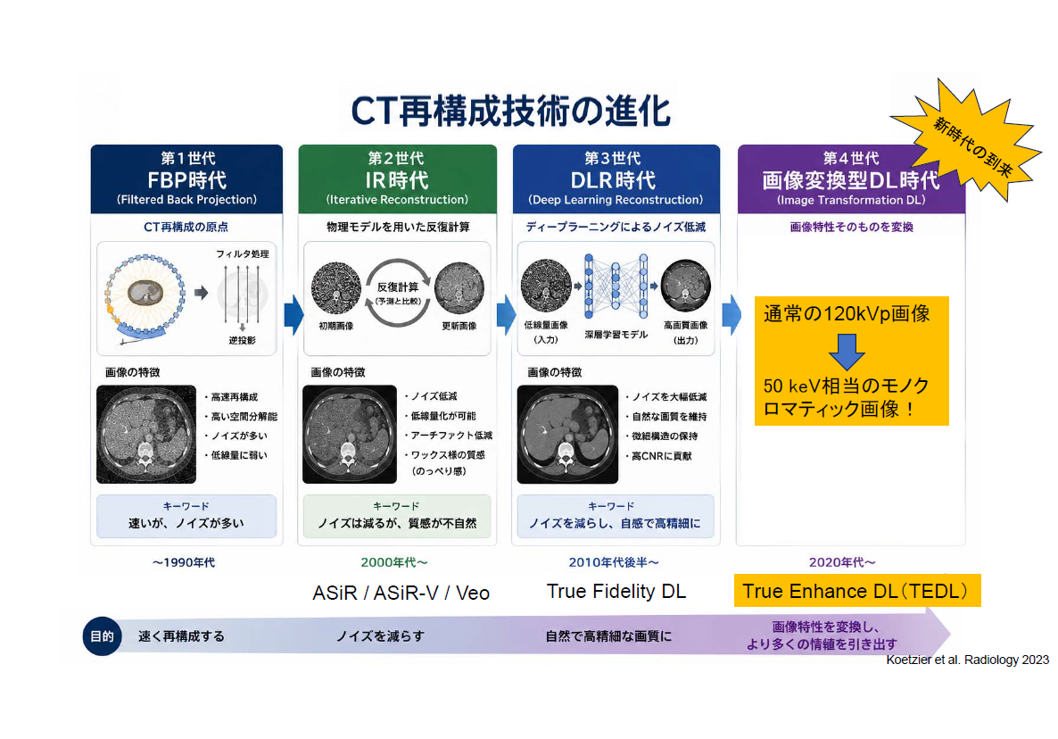 CT再構成技術の進化