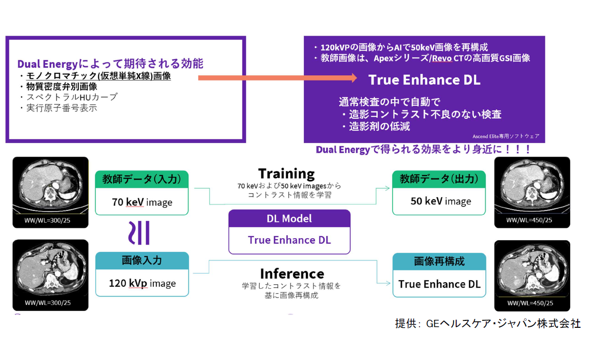 True Enhance DL の概要