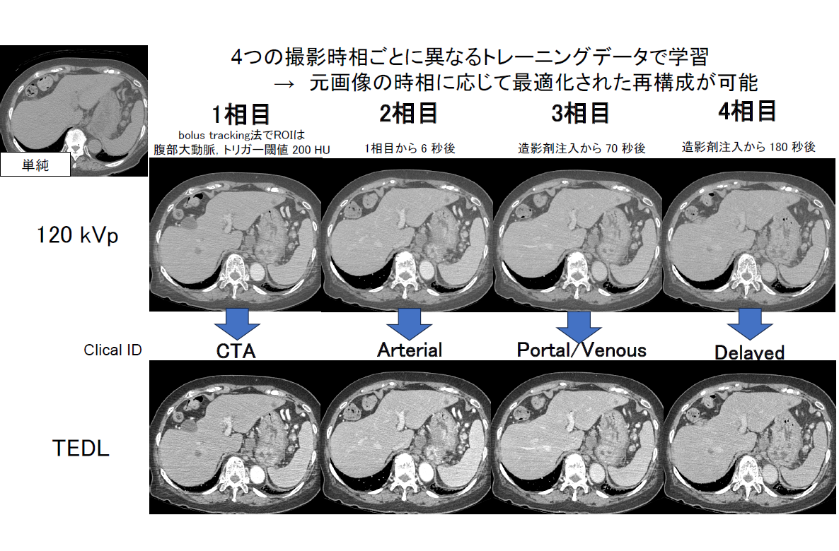TEDLにより再構成された画像
