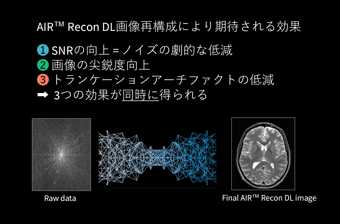 AIR Recon DLの3つの効果