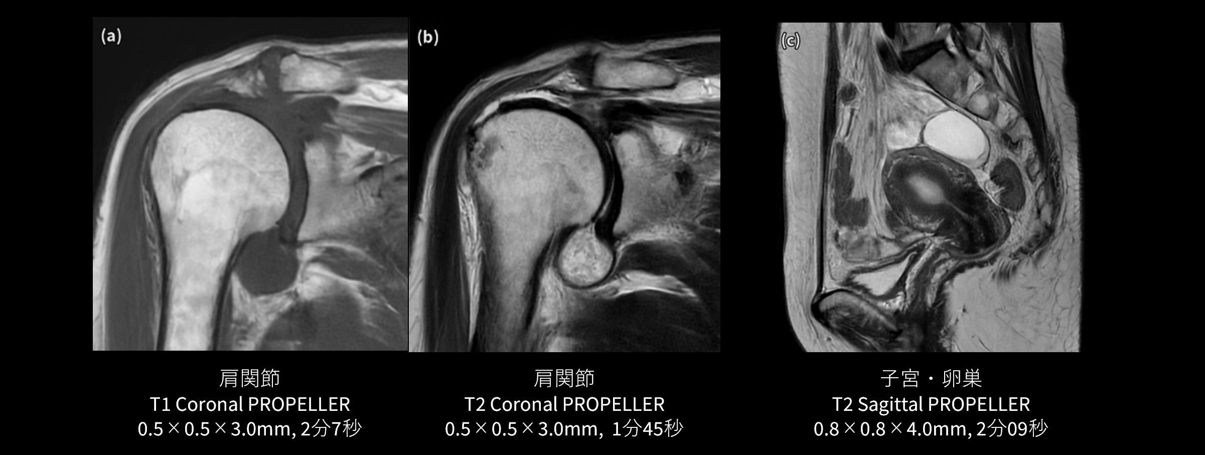 ルーチン検査でのPROPELLER MB&times;AIR Recon DL活用例