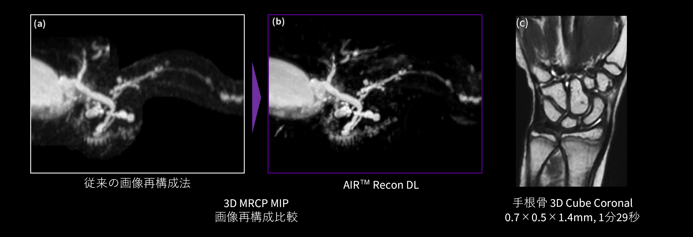 3D撮像におけるAIR Recon DL活用例