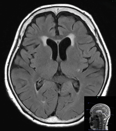 2026年3月 ベテラン技師