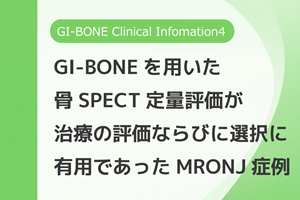 GI-BONE_CI4.png