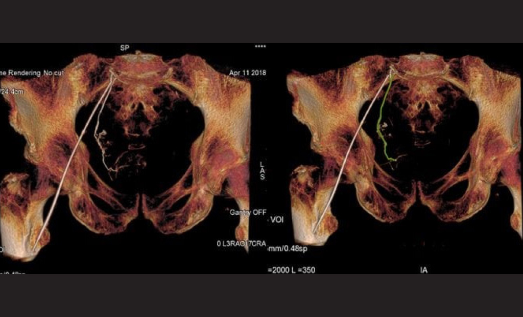 Photo of X-ray
