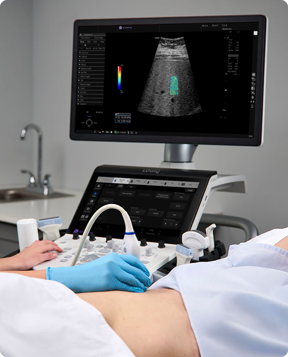 LOGIQ ultrasound